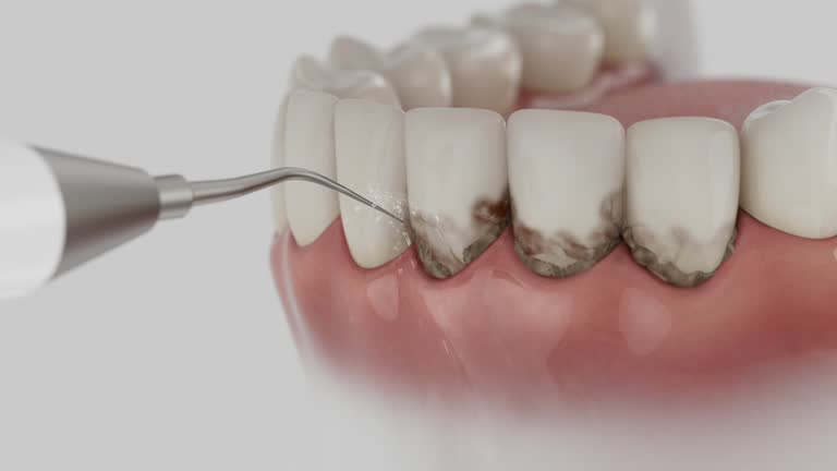 Trusted Emergency Dentist service in Bradford Woods, PA - Dentist Open Now